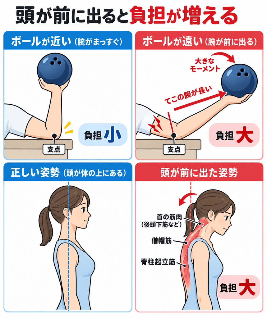 頭が前に出ると首や肩への負担が増えることを、ボーリングの玉と姿勢で比較したイラスト