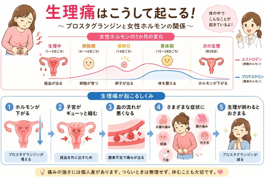 生理痛の仕組みを女性ホルモンとプロスタグランジンの流れでわかりやすく解説したイラスト