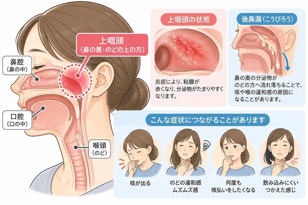 東大阪市のおおくま整骨院が、上咽頭炎と咳・喉の違和感の関係を解説。鼻の奥にある上咽頭の位置や炎症、後鼻漏によって咳や喉のムズムズ感が起こる仕組みを示したイラスト。