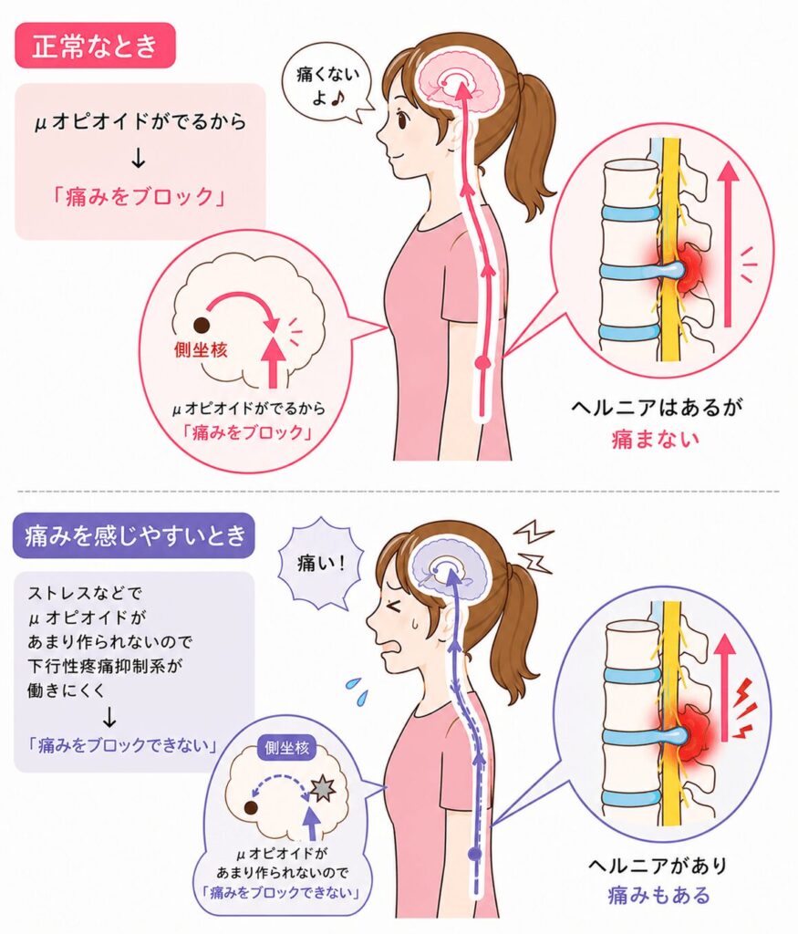 下行性疼痛抑制系の説明図