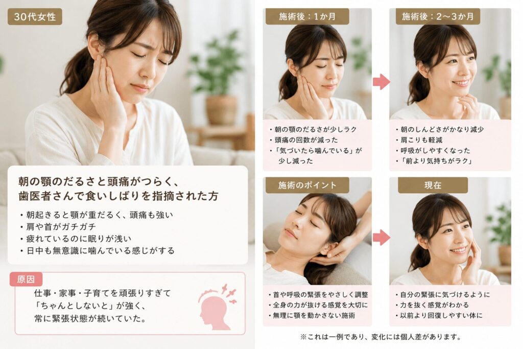 食いしばりの30代女性の主訴から経過についての説明図