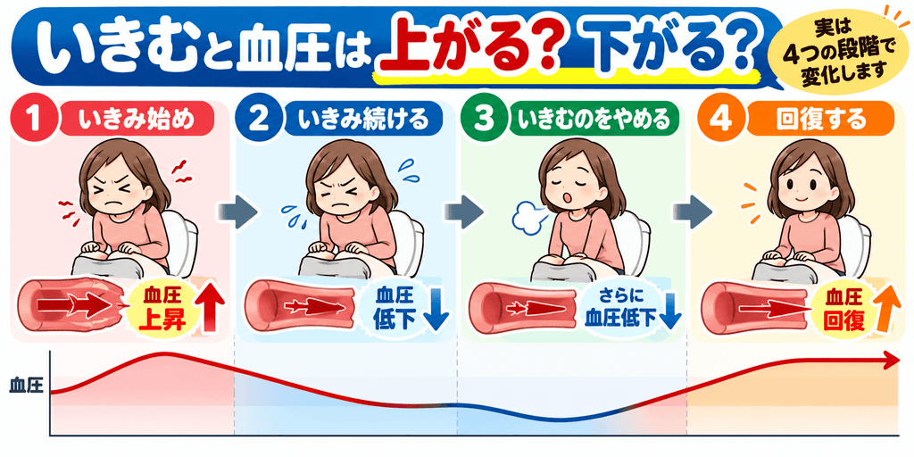 排便時のいきみによるバルサルバ動作を4段階で解説。いきみ始めの血圧上昇、いきみ継続中の血圧低下、力を抜いた直後の一時的な低下、回復時の血圧上昇を示したイラスト。