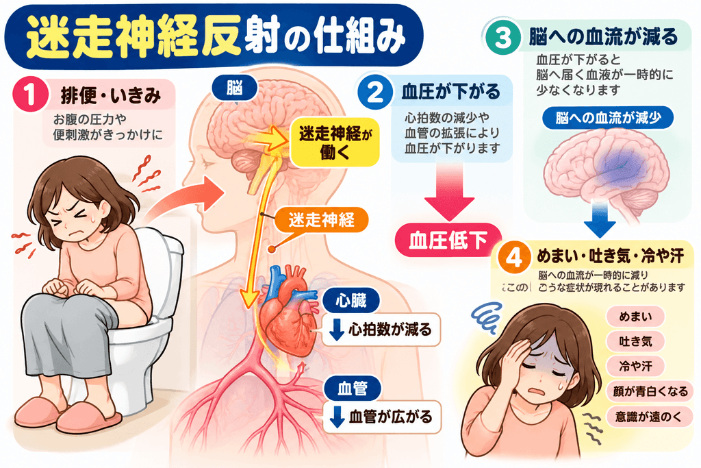 排便時の迷走神経反射の仕組みを示すイラスト。自律神経の反射によって心拍数や血圧が低下し、脳への血流が一時的に減少することで、めまい・吐き気・冷や汗などが起こる様子を解説。